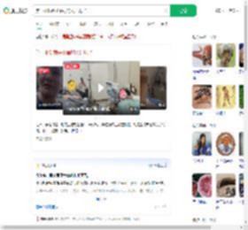 第一批吃菌子中毒的人出现了_360搜索